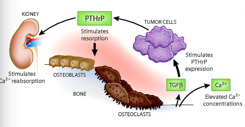 <p>1. tumor production of PTH or PTHrp</p><p>2. tumor production of proteins acting on osteoblasts or osteoclasts (stimulate bone resorption and increased calcium)</p><p>3. tumor induced production of vitamin D</p><p>4. direct tumor lysis of bone (extensive and usually multifocal lesions)</p>