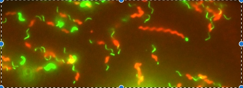 <p>“Darting” motility (corkscrew movement) on hanging drop preparations</p>