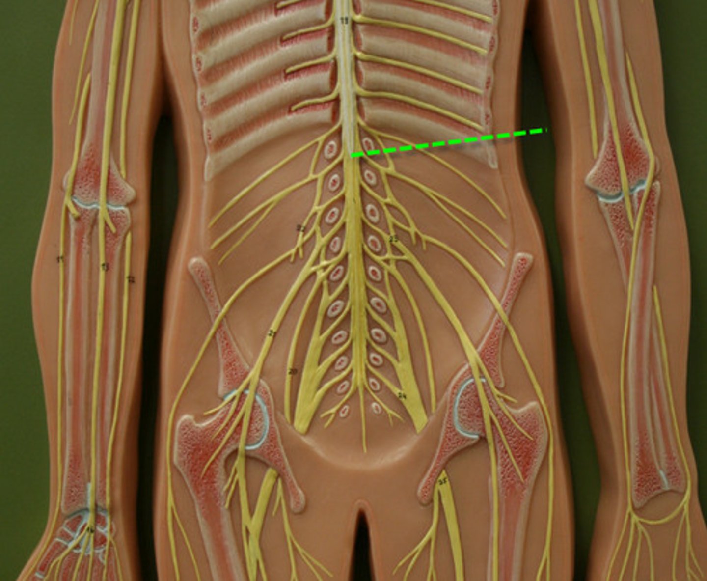 <p>Cone-shaped end of spinal cord at L1-2.</p>
