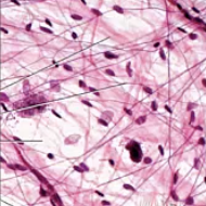 <p>what type of tissue is this</p>