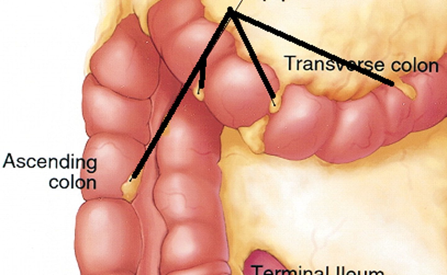 <p>Lobules of fat hanging off external surface of haustra</p>