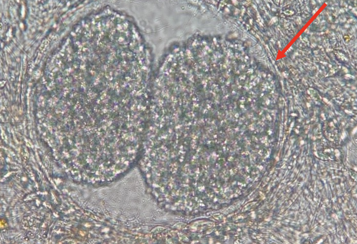 <p>What kind of parasite and what stage is the image depicting? How did the parasite get to this stage?</p>