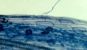 fungi phylum that contains arbuscular mycorrhizae (AM fungi) 