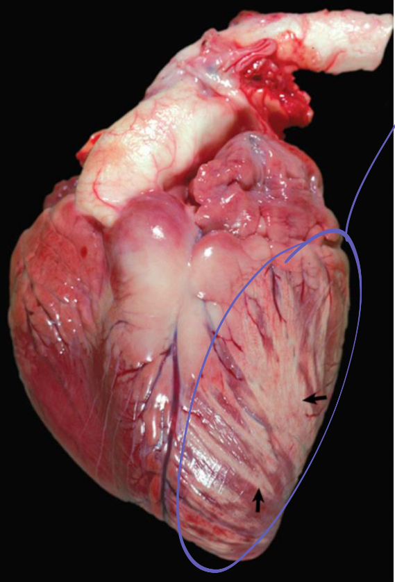 <p>what is being shown in this heart</p>