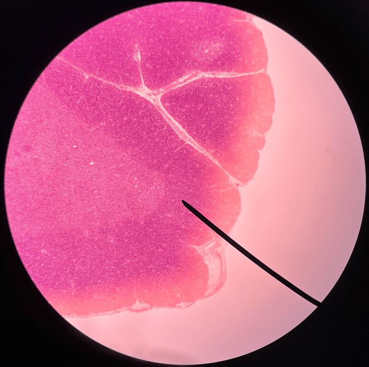 The outer layer of a thymus lobule.