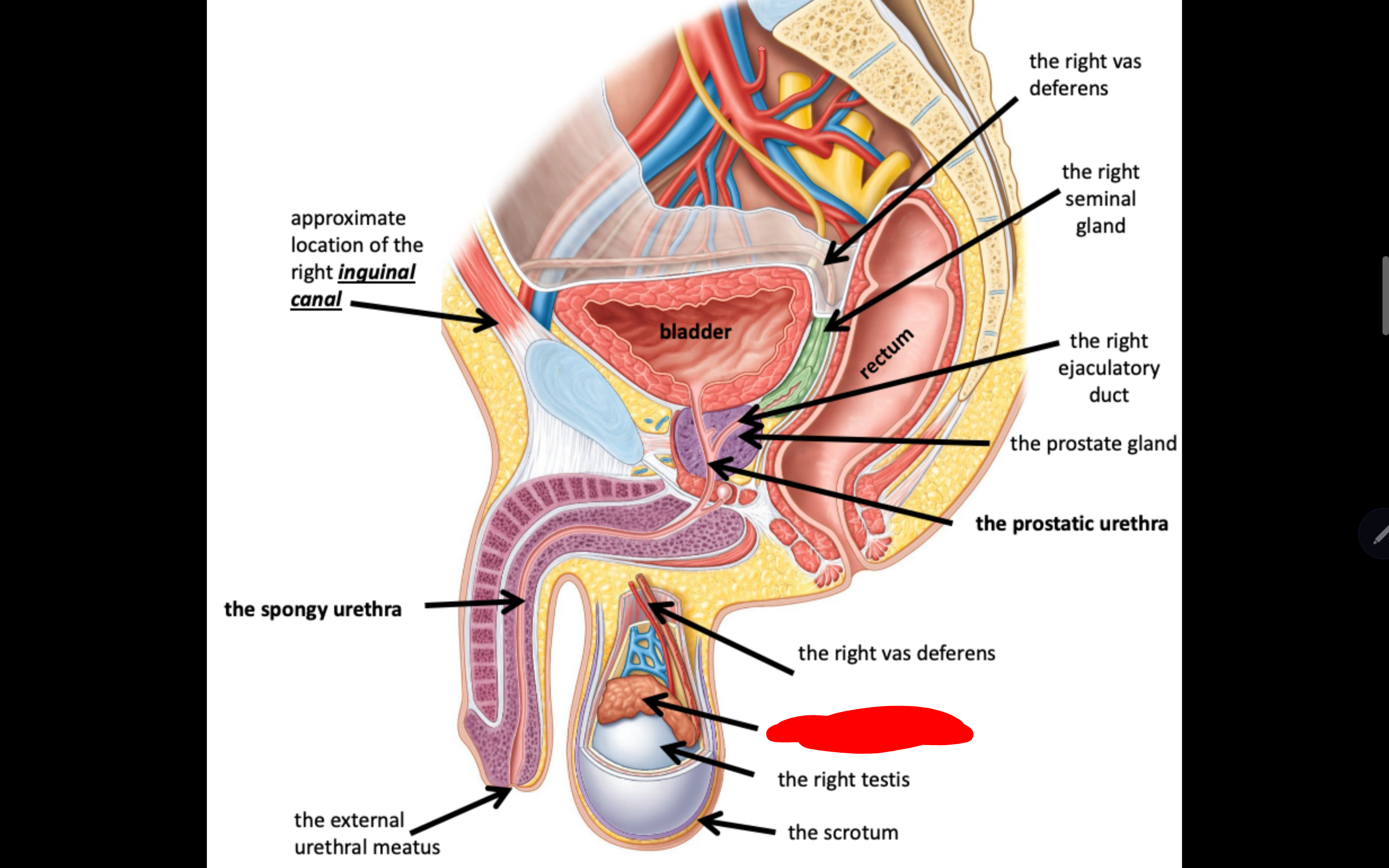 <p>Name the structure in red</p>