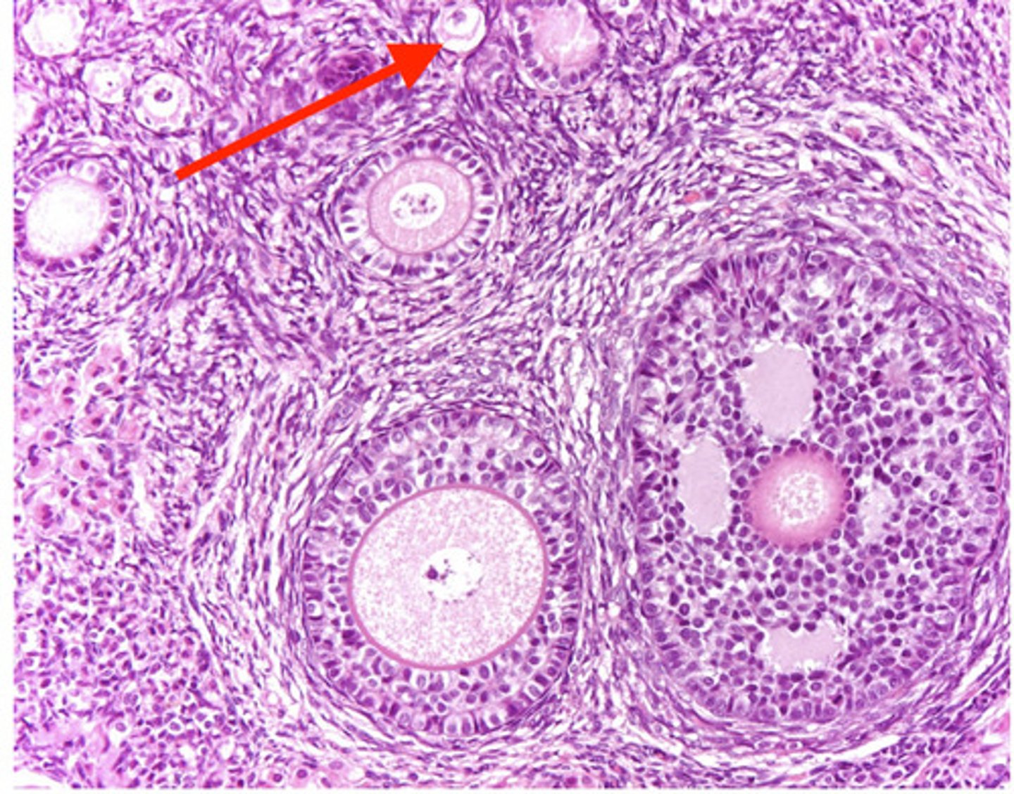 <p>what type of follicle?</p>