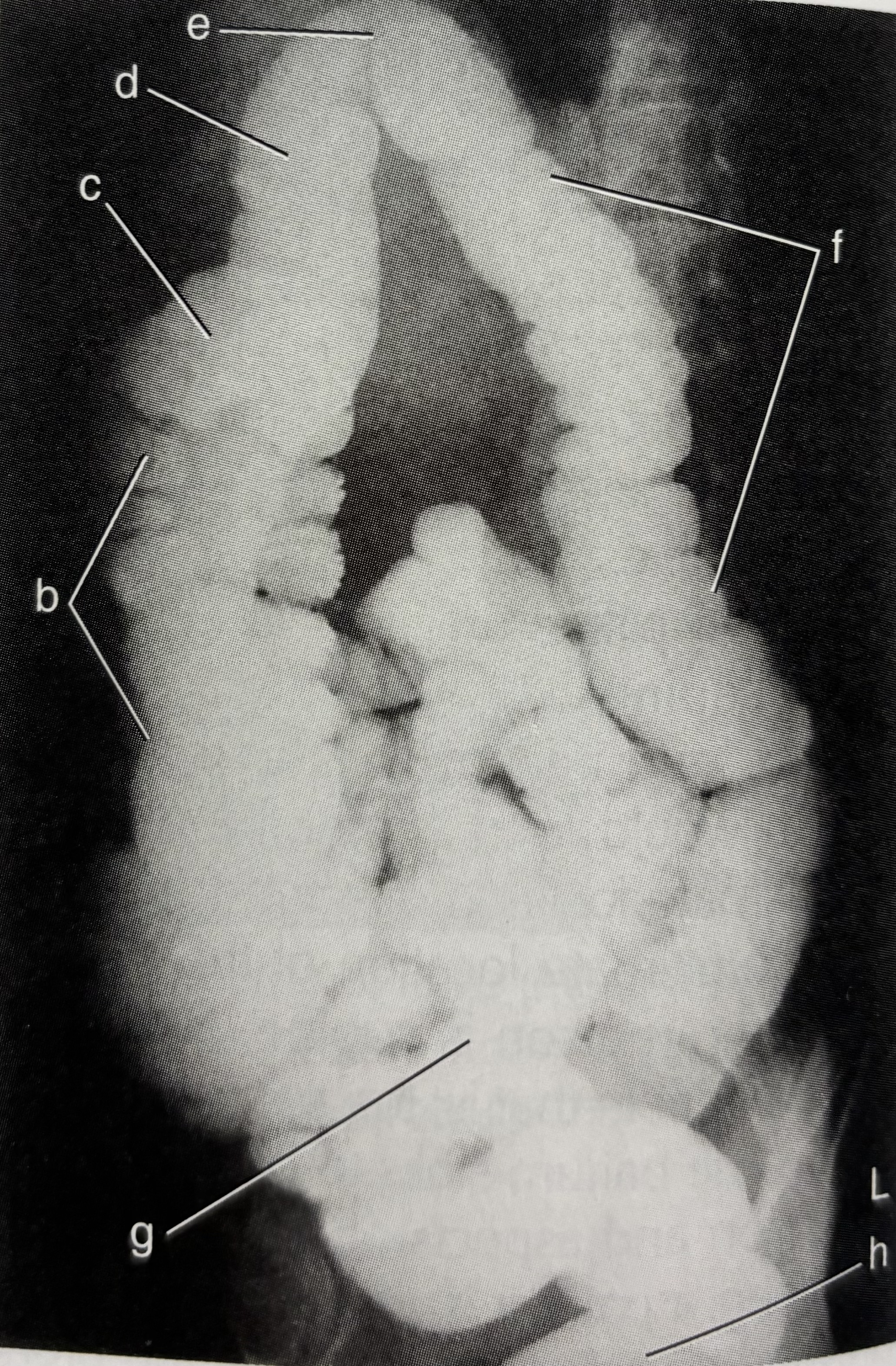 <p>What is F pointing to?</p>