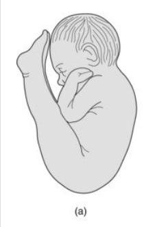 <p>thighs flexed at the hips and lower legs extended in front of head </p><p>sometimes the fetus can be turned in this position to ensure safe vaginal delivery </p>