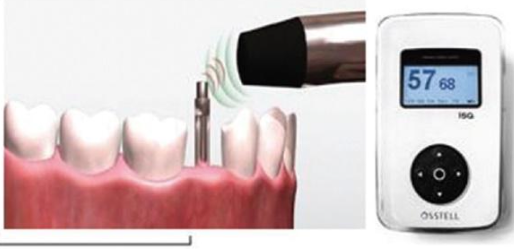 <p>What does this mean? </p>