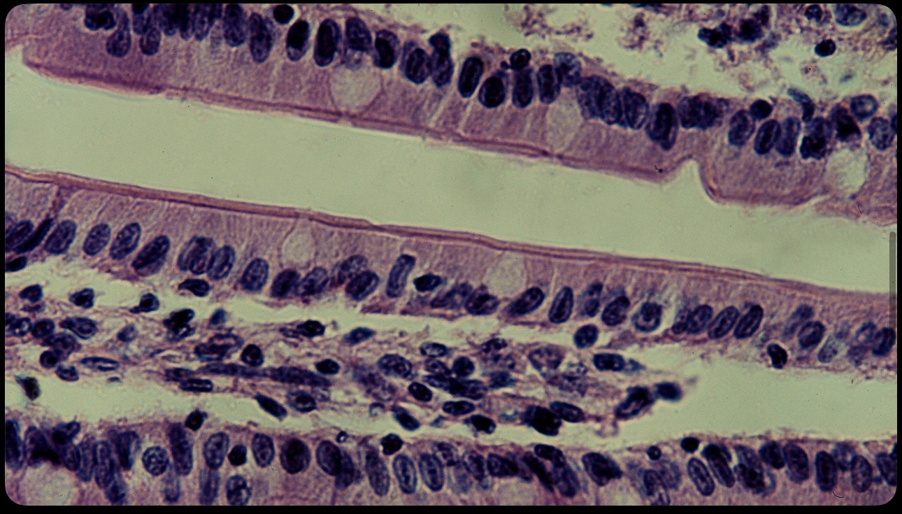 <p>Células epiteliales cilíndricas con microvellosidades </p>