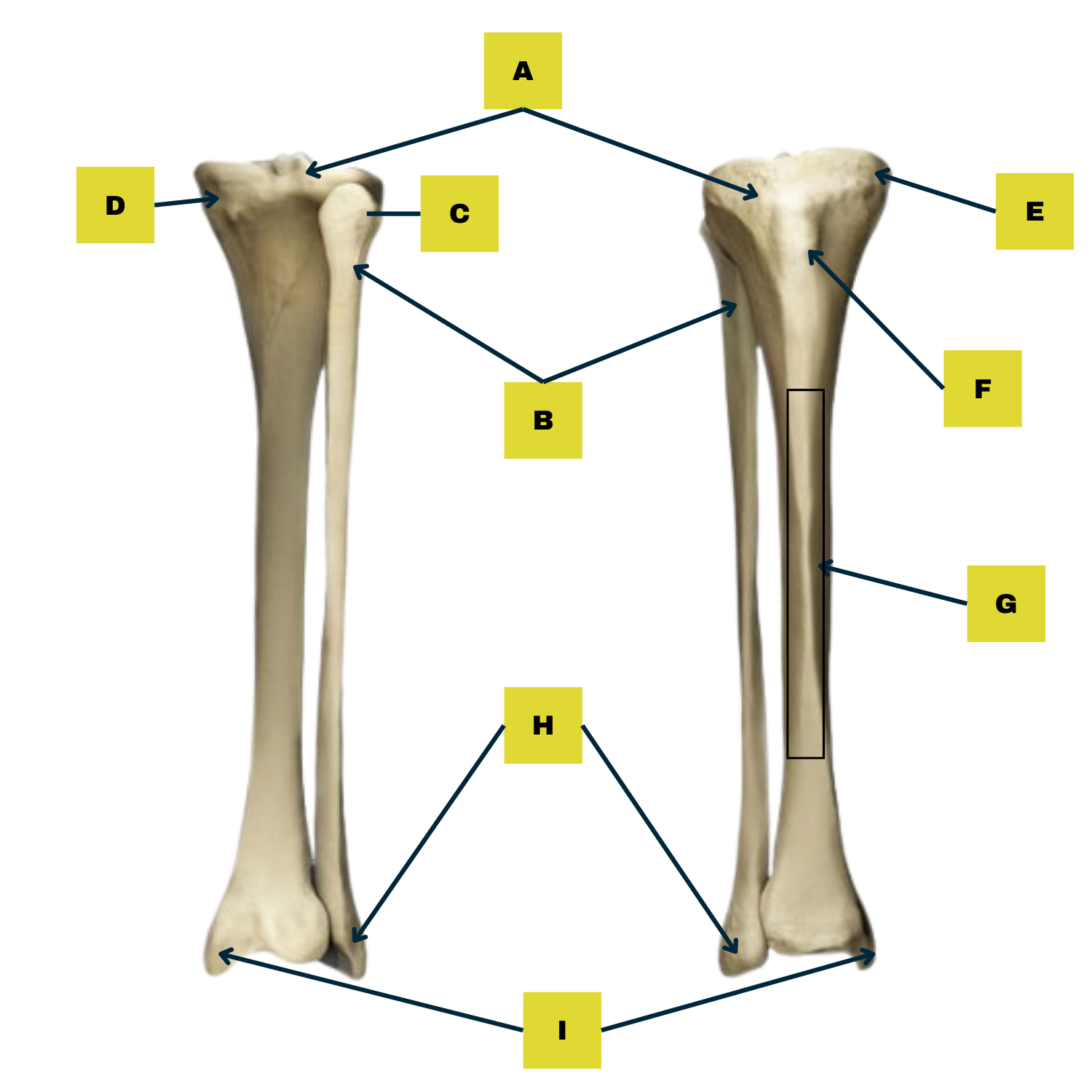 <p>B: What is the name of this bone?</p>