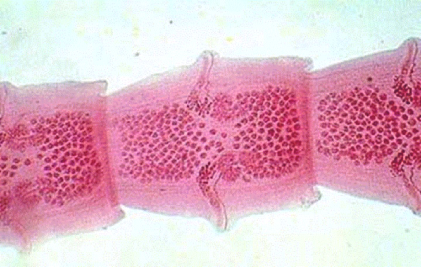 <p>Rectangular sections of a tapeworm; Phylum Platyhelminthes; Class Cestoda</p>