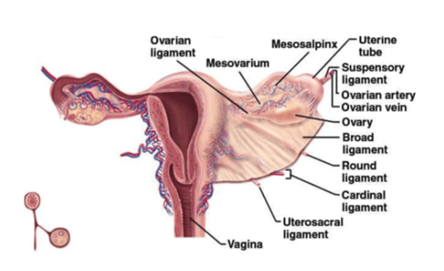 <p>Ovarian ligament</p><p>3 multiple choice options</p>