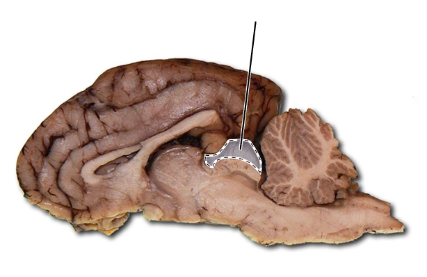 <p>Name the part of the brain that is highlighted.</p>