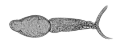 <p>What life cycle of schistosoma is this?</p>