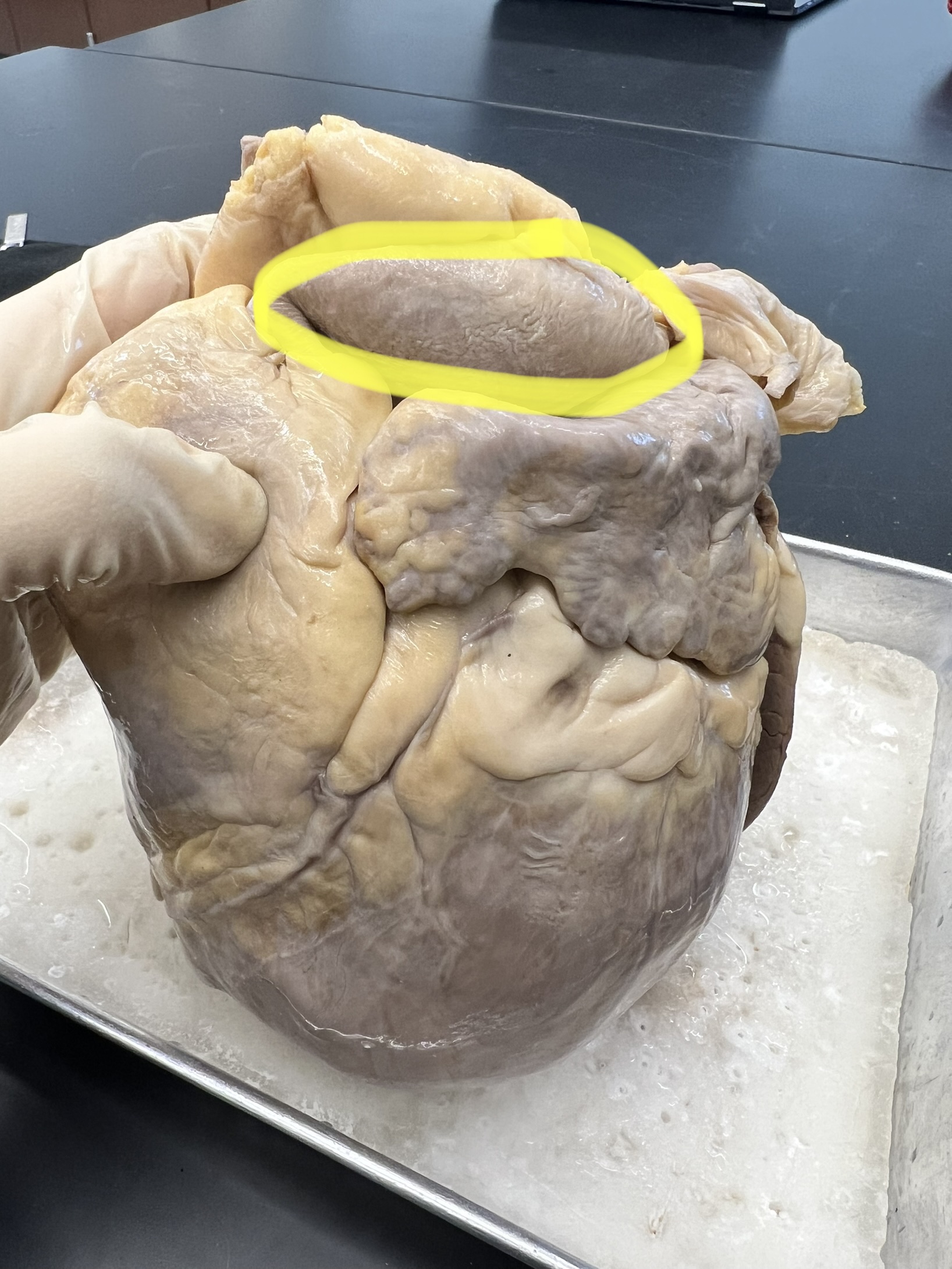 Name the heart structure.