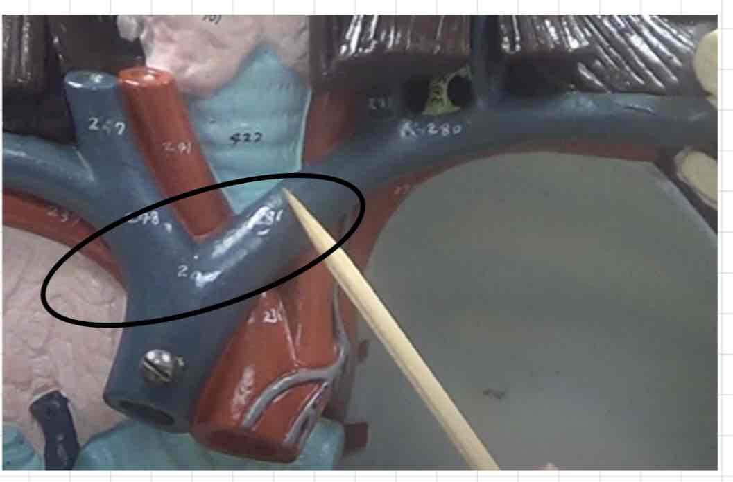 <p>what is this? (torso model)</p>