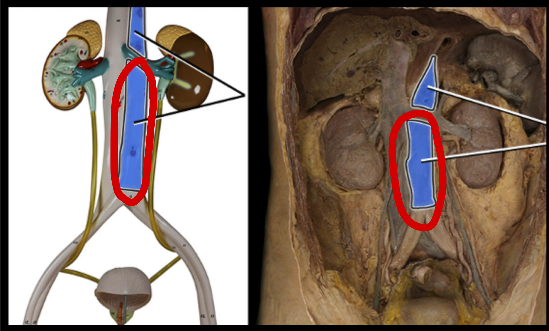 <p>When the aorta enters the abdominal cavity</p>