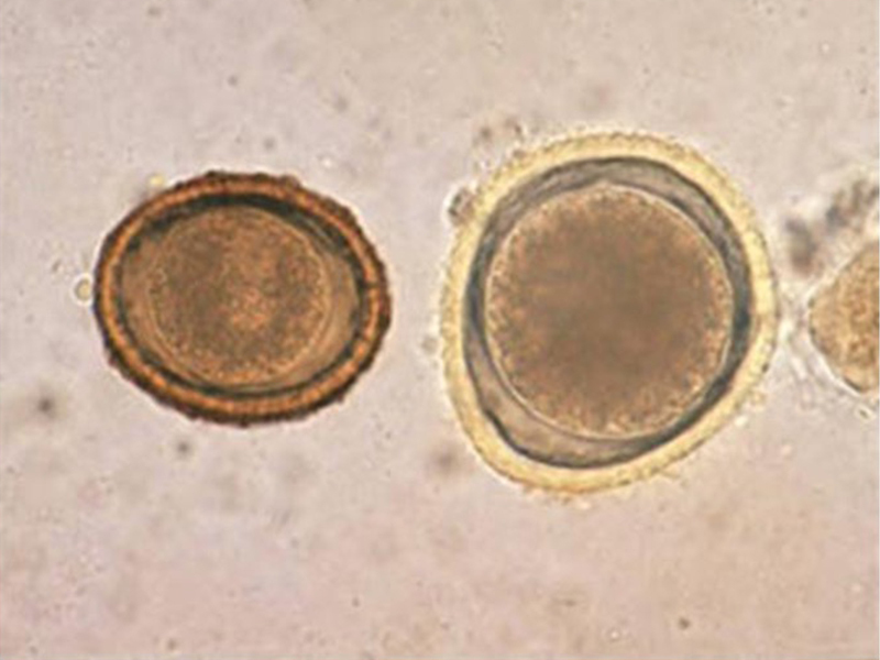 <p>Baylisascaris procyonis</p>