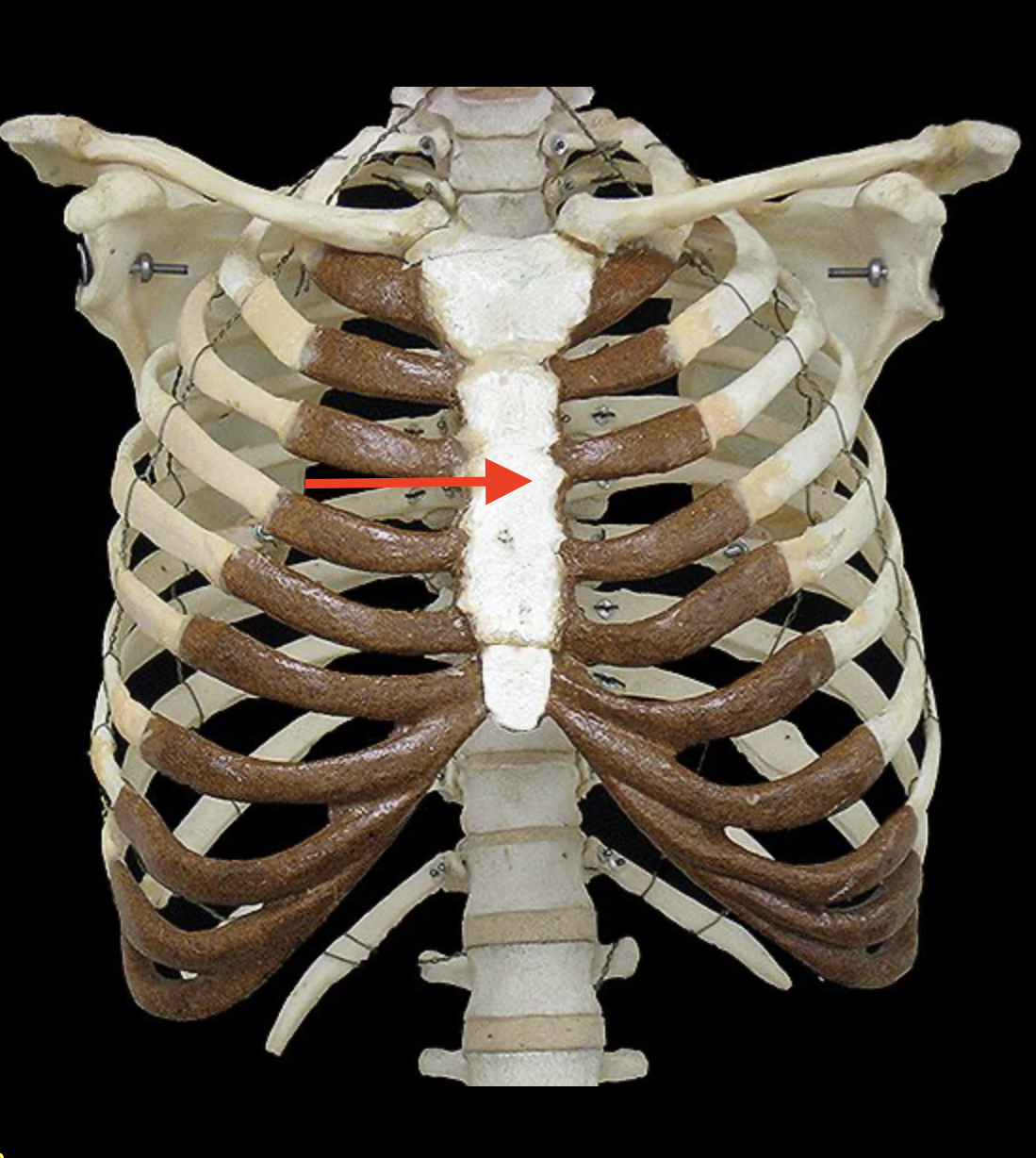 term image