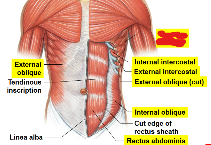 <p>What muscle is this?</p>