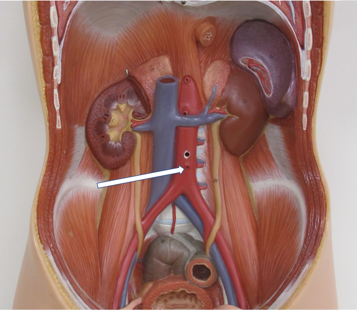 <p><span>Van welk bloedvat zien we hier de opening in de aorta?</span></p>