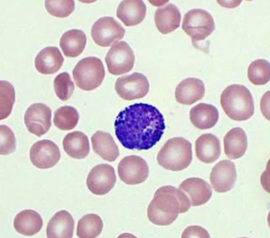 <p>full of granules- can’t see the nucleus because the granules cover it</p><ul><li><p>lumpy texture</p></li><li><p>bumpy on the sides of the cell because of granules</p><ul><li><p>dont confuse with lymphocyte</p></li></ul></li></ul><p></p>