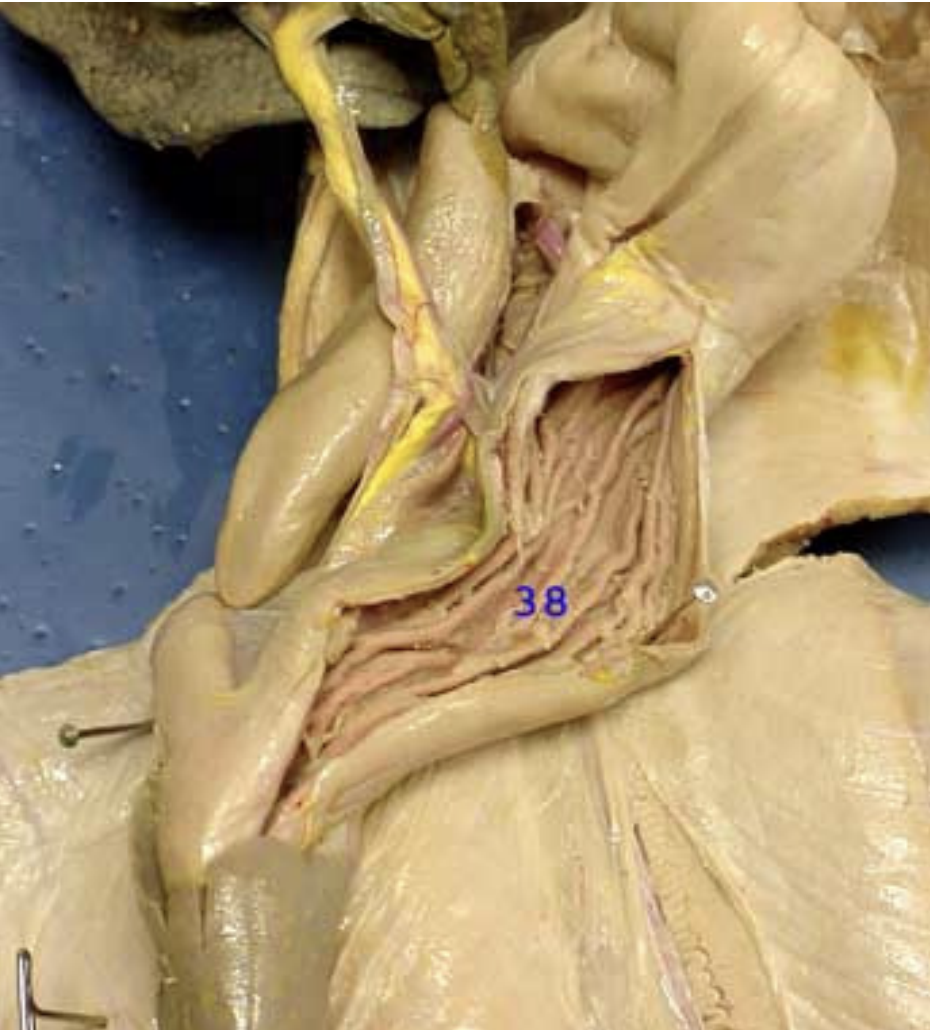 <p>What organ is this in?</p>