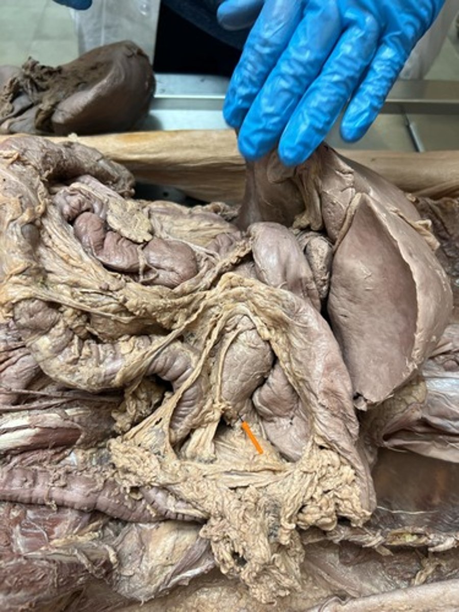 <p>tail of pancreas</p>