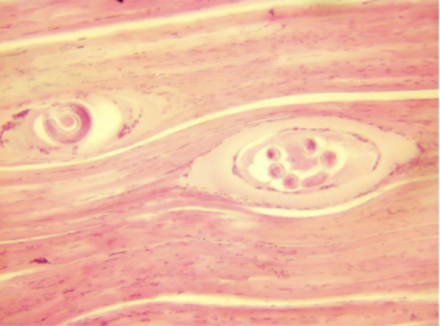 <p>Trichinella (encysted larvae in muscle) - nematode</p>