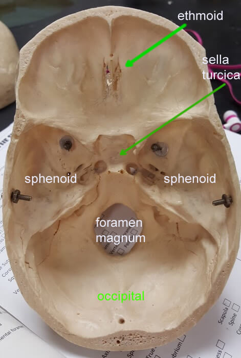 <p>sphenoid bone</p>