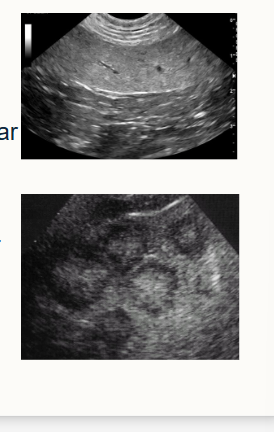 <p>Heterogeneous (non-uniformed, mixed) = mixed/irregular pattern (common in finding diseased tissue)</p><p>Homogeneous (uniform)  = similar and regular pattern throughout (most normal tissues)</p>