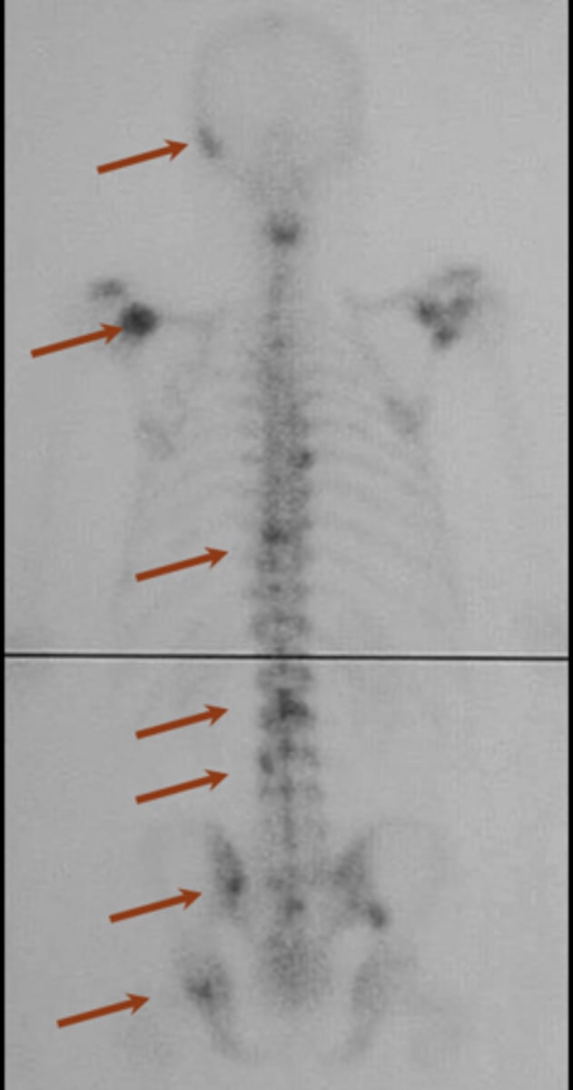 <p>ID imaging technique</p>