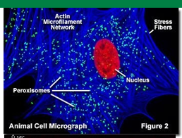 <ul><li><p>DNA stain (viswualize nucleas in red) </p></li><li><p>Actin microfilament network (shown in blue) </p></li><li><p>Catalase enzyme labelled with antibody (green) </p></li><li><p>Each bright feen stain represents individual peroxisomes</p></li><li><p>Fluorescence can look at living cells while TEM cannot</p><ul><li><p>Peroxisomes aren’t static </p></li><li><p>They move around, change shape, undergo fission/fusion&nbsp;</p></li></ul></li></ul><p></p>