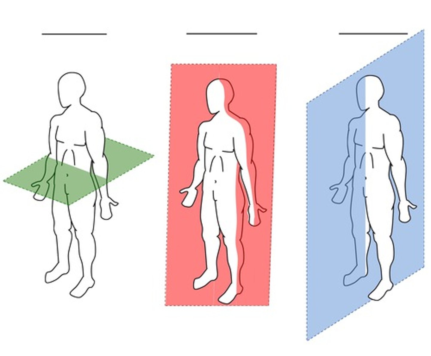 <p>3 body planes</p>