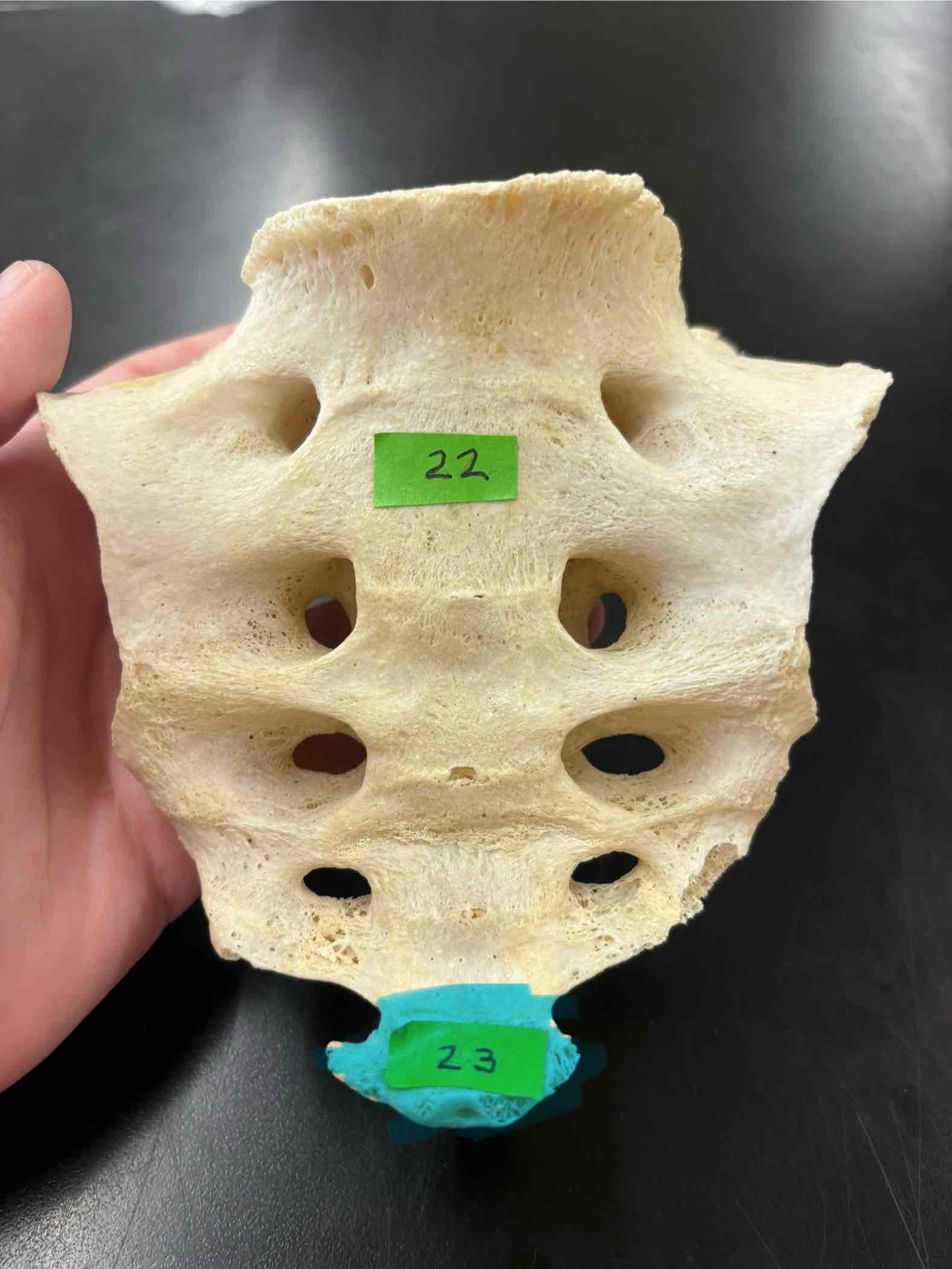 <p>What is the name of this bone?</p>