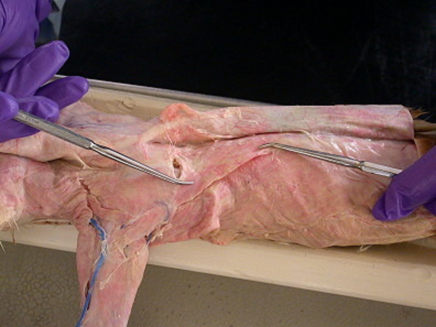 <p>name this muscle</p>