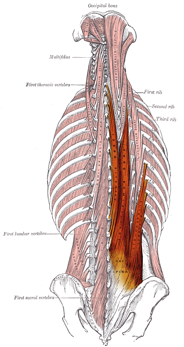 <p>Erector Spinae (iliocostalis, longissimus, spinalis) that extend from lower back region to various attachments superiorly)</p>