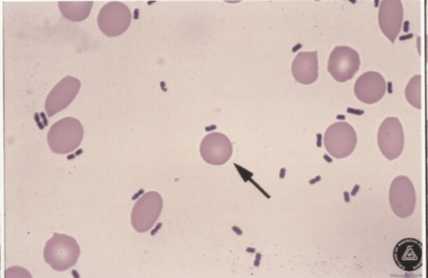 <p>Identify the cells in this body fluid</p>