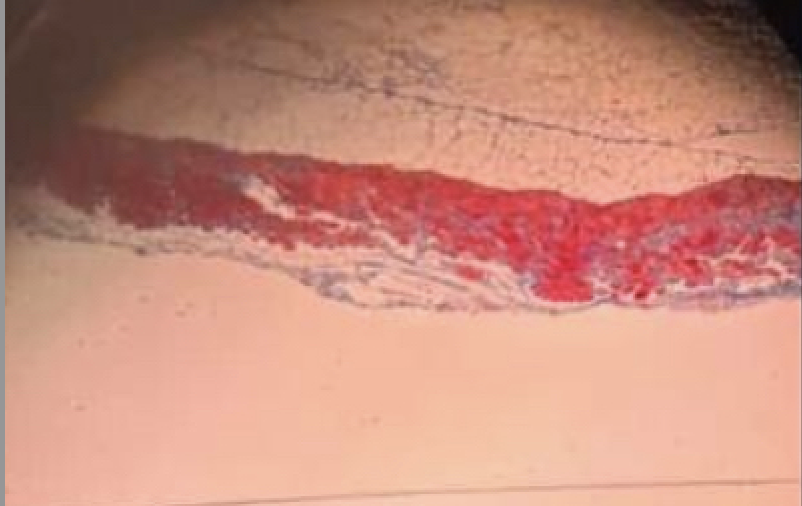 <p>Name the Tissue?</p>