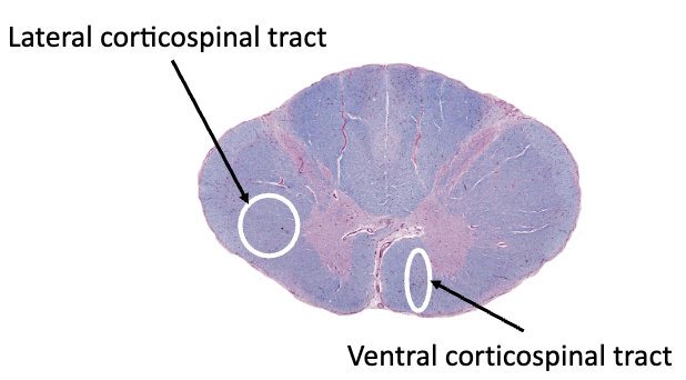 <p><strong>direct motor pathways</strong></p><ul><li><p>ventral (anterior) corticospinal tract</p><ul><li><p>motor cortex control of skeletal muscles on _____ sides of the body</p></li><li><p>trunk movements (trunk moves as a unit)</p></li><li><p>most of the fibers cross in the spinal cord and some don’t&nbsp;</p></li></ul></li></ul><p></p>