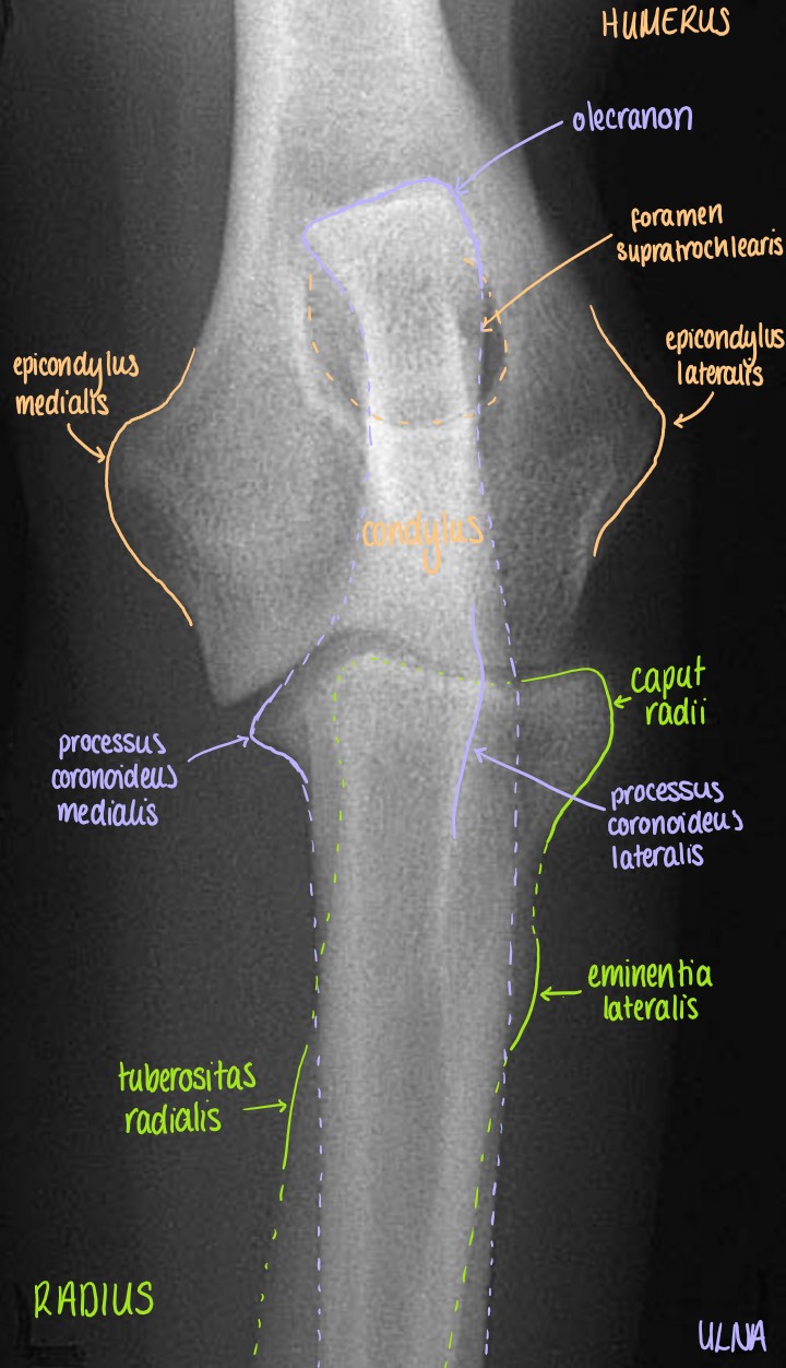Cranio-Caudal Projection of the Articulatio Cubiti