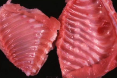 <p>Patho ostéogenèse imparfaite (= Os de verre)</p>