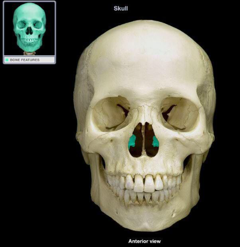 <p>What bone is this?</p>