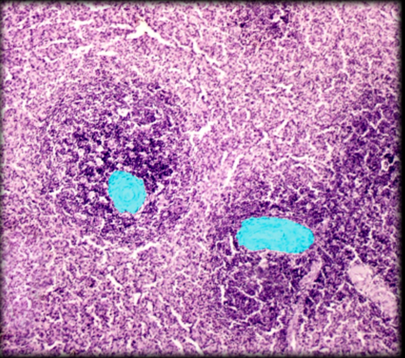 <p>Spleen</p>