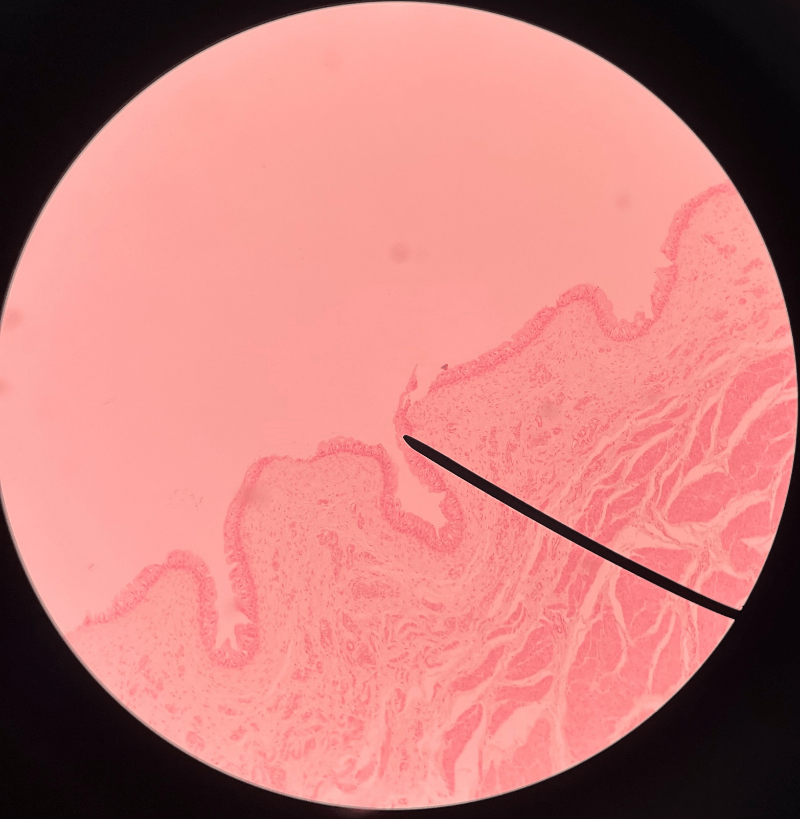 • Slide histology of the bladder.

• The innermost layer of the bladder.

• Composed of urothelium.

• Faces the lumen of the bladder and is deep to the submucosa.
