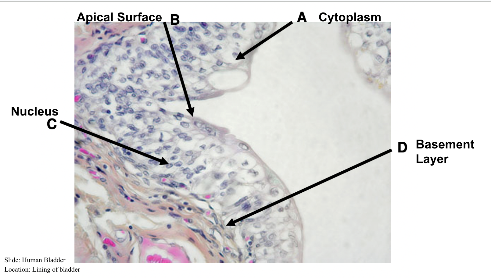 <ul><li><p><span style="background-color: transparent;">Lack blood vessel/Line all blood vessels in your body</span></p></li><li><p><span style="background-color: transparent;">Tightly packed</span></p></li><li><p><span style="background-color: transparent;">Readily divide&nbsp;</span></p></li><li><p><span style="background-color: transparent;">Faces the free (apical → exterior of the body) surface</span></p></li><li><p><span style="background-color: transparent;">Anchored by a basement membrane (that connects epithelium to connective tissue)</span></p></li></ul><p></p>