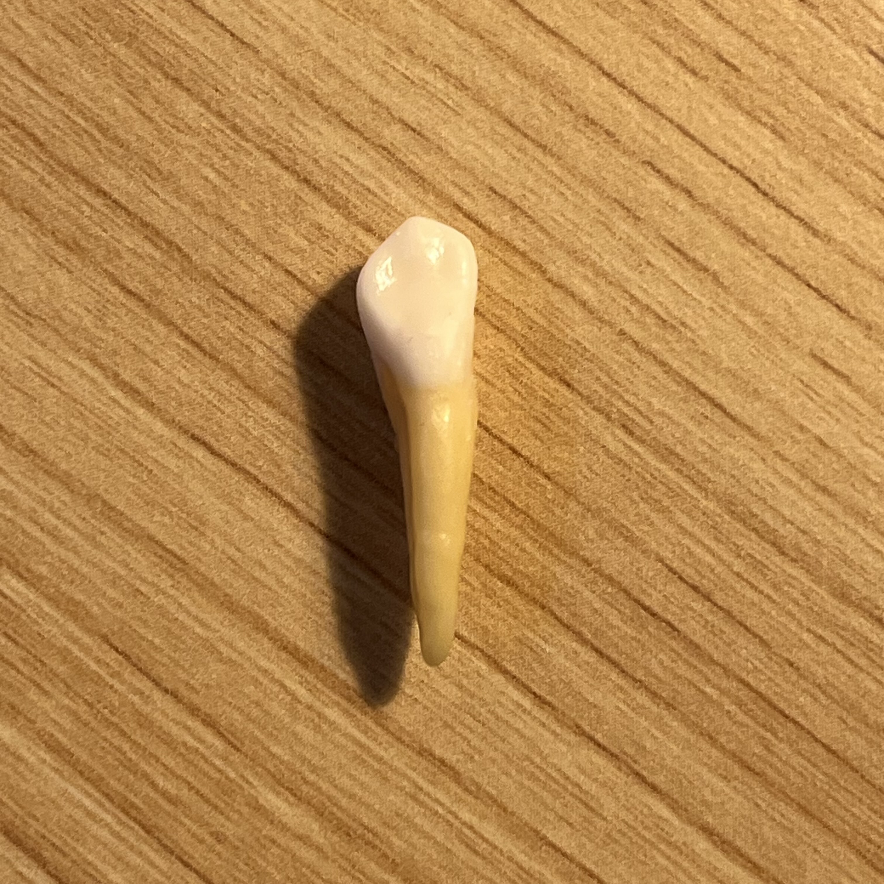 <p>What tooth is this (with view)?</p>