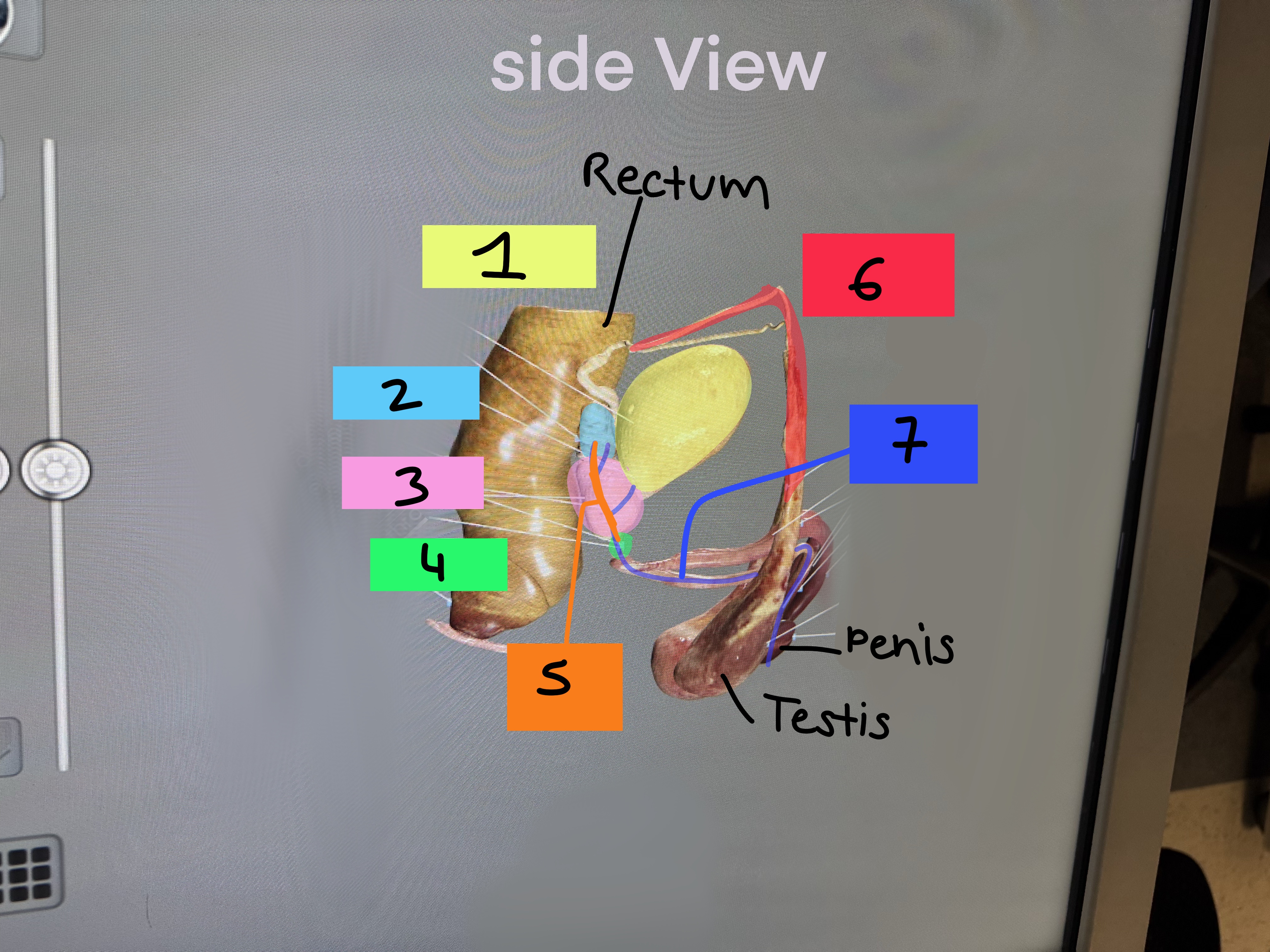 <p>Viktor Reproductive Cadaver: 1-3</p>
